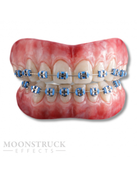 Moonstruck Effects Anwen ProFX Teeth With Blue Braces