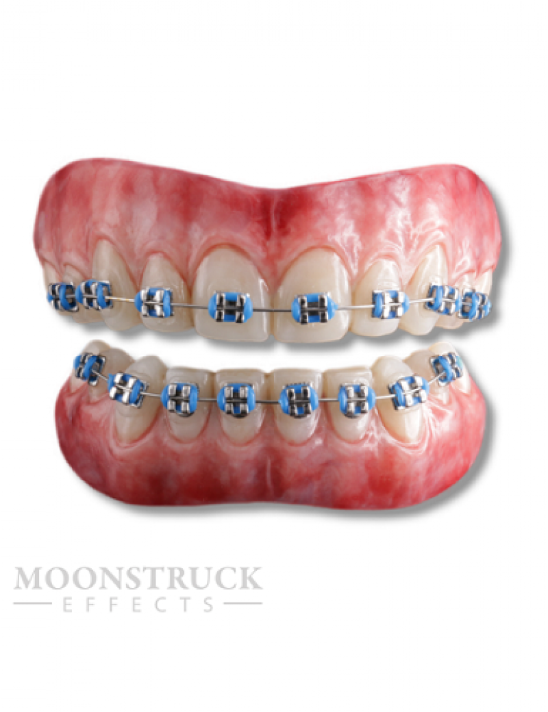 Moonstruck Effects Anwen ProFX Teeth With Blue Braces