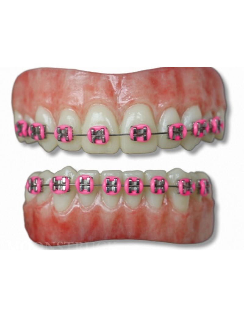 Moonstruck Effects Anwen ProFX Teeth With Pink Braces