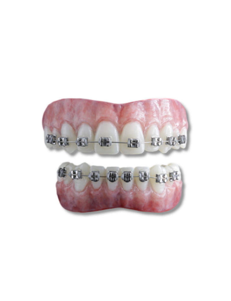 Moonstruck Effects Anwen ProFX Teeth With Silver Braces