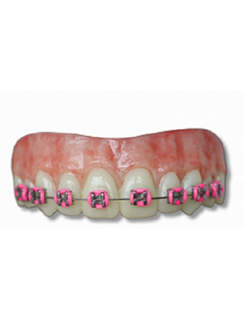 Moonstruck Effects Lemmy ProFX Teeth With Pink Braces