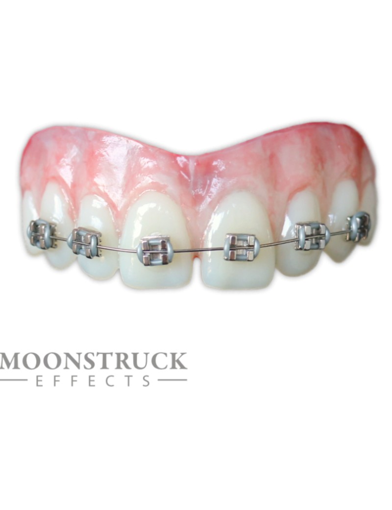 Moonstruck Effects Lemmy ProFX Teeth With Silver Braces