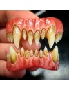 Moonstruck Effects Azrael ProFX Teeth