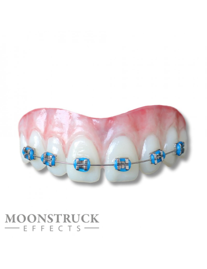 Moonstruck Effects Lemmy ProFX Teeth With Blue Braces