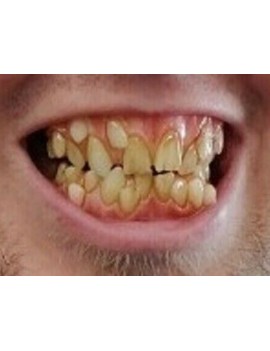 Moonstruck Effects Mormo ProFX Teeth