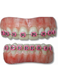 Anwen Braces Pink