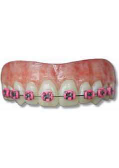 Lemmy Braces Pink