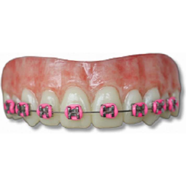 Moonstruck Effects Lemmy ProFX Teeth With Pink Braces