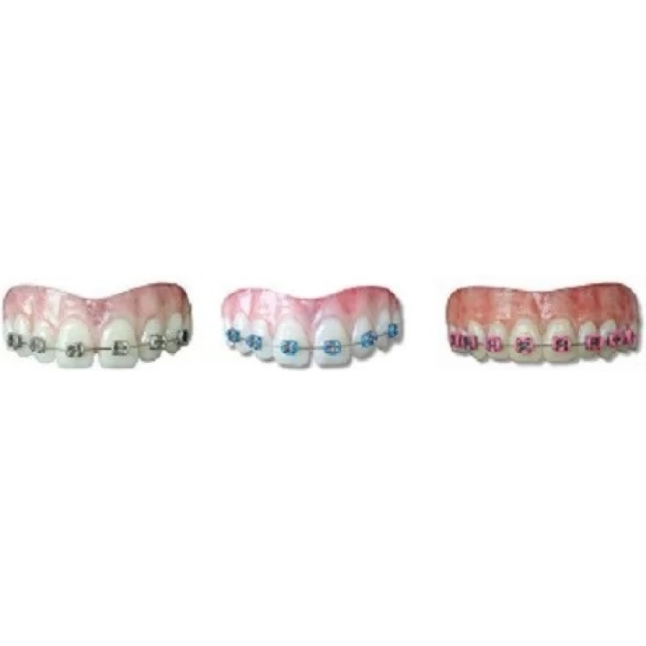 Moonstruck Effects Lemmy ProFX Teeth With Silver Braces
