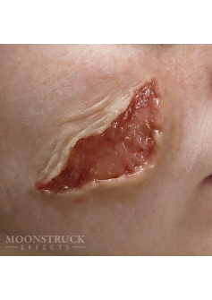 Moonstruck zombie wound 1