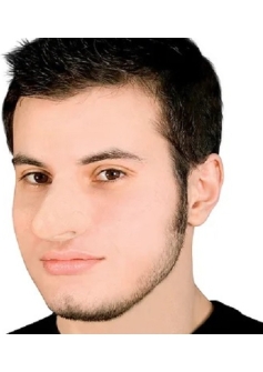 Prosthetic Nose Normal