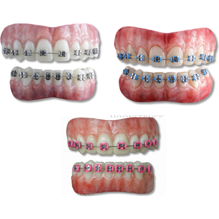 Moonstruck Effects Anwen ProFX Teeth With Pink Braces